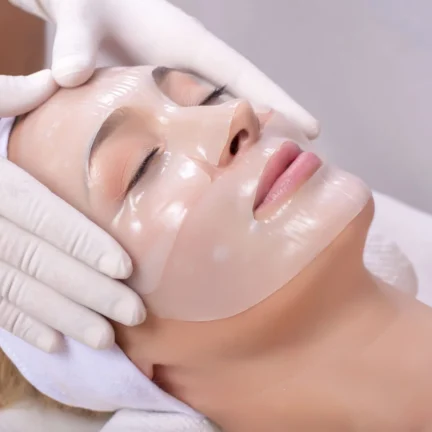 Chemical Peel