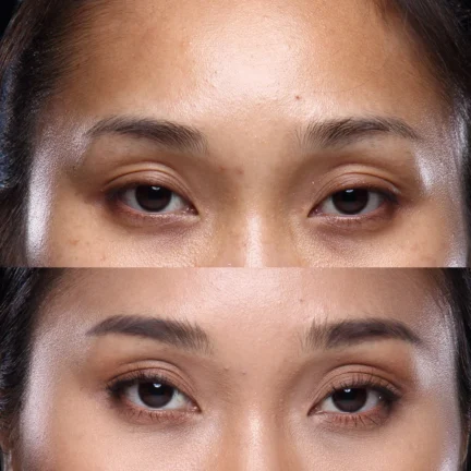 cosmetics clinic in trivandrum